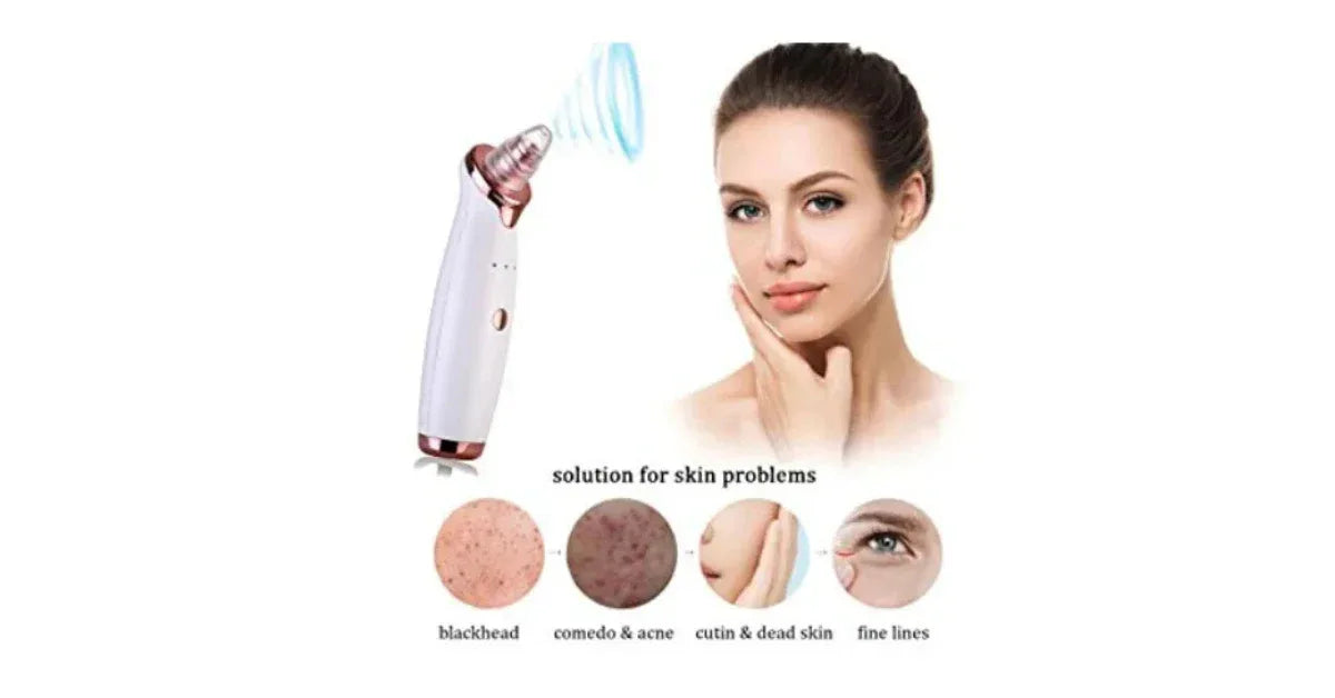New USB Rechargeable Electric Blackhead Remover Vacuum Suction Pore Cleanser | Best Blackhead Remover 2025 - vitaliqa